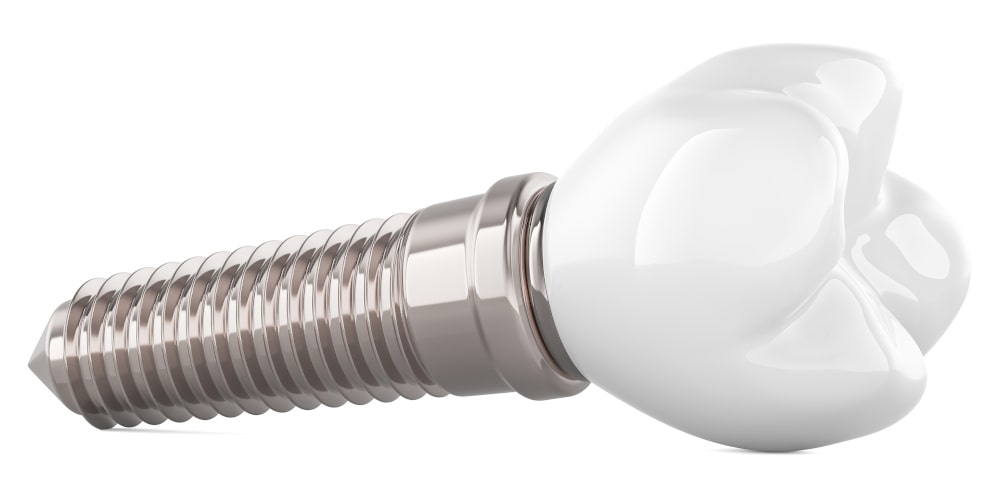 Are Zirconia Implants as Durable as Titanium Implants Over Time?