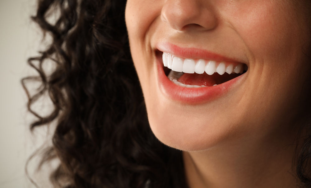 Close-up of smiling woman showing bright, even teeth after dental bonding or porcelain veneers cosmetic treatment.